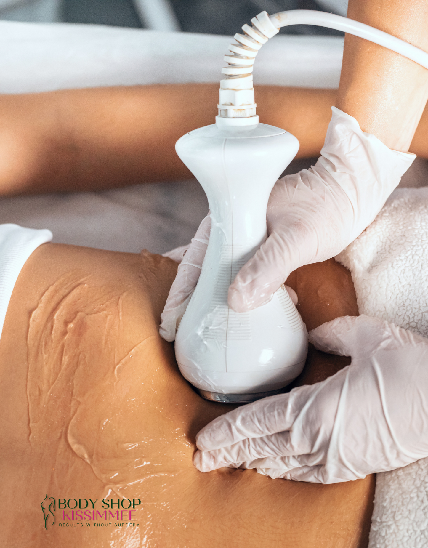 Ultrasonic Cavitation