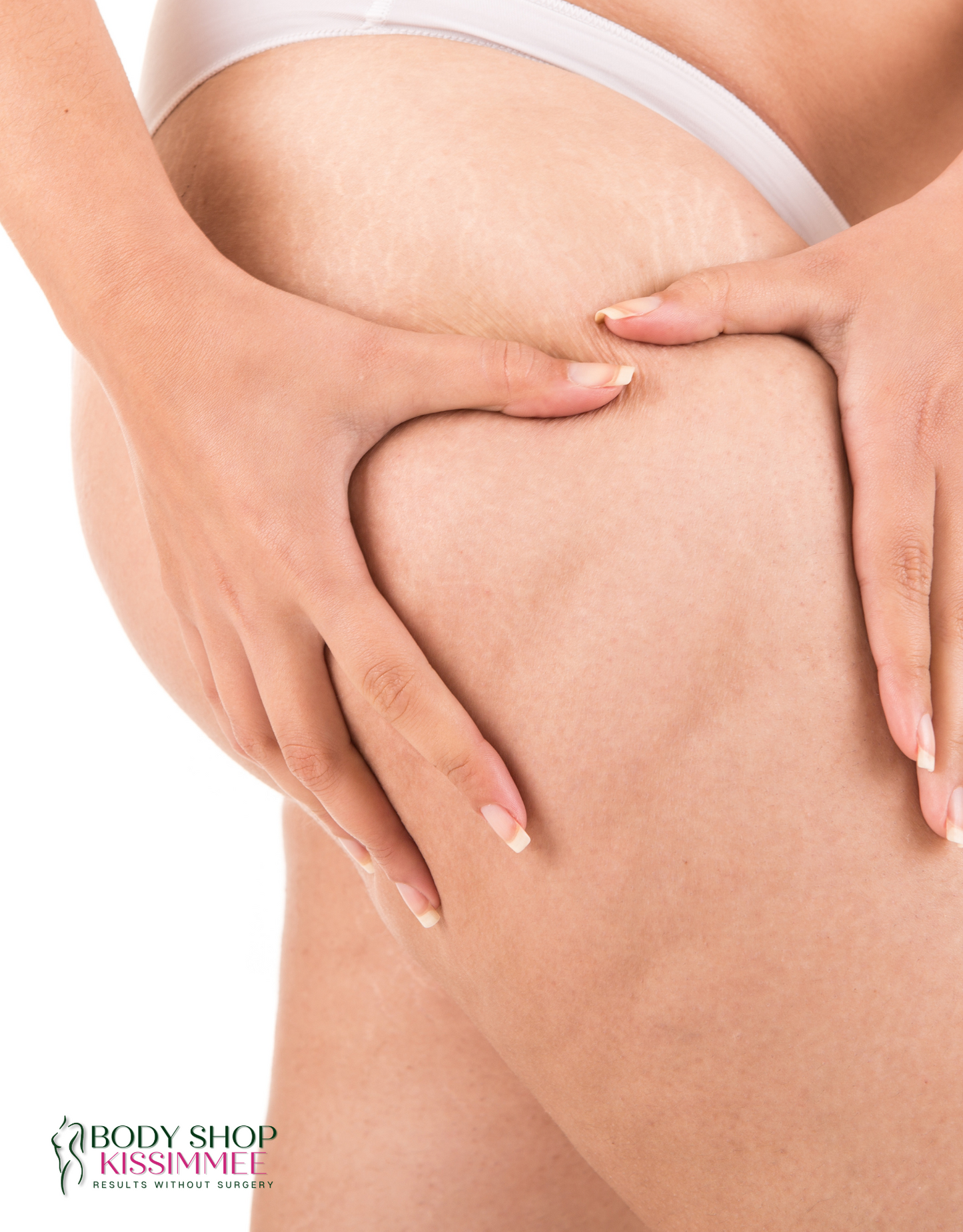 Cellulite Treatment