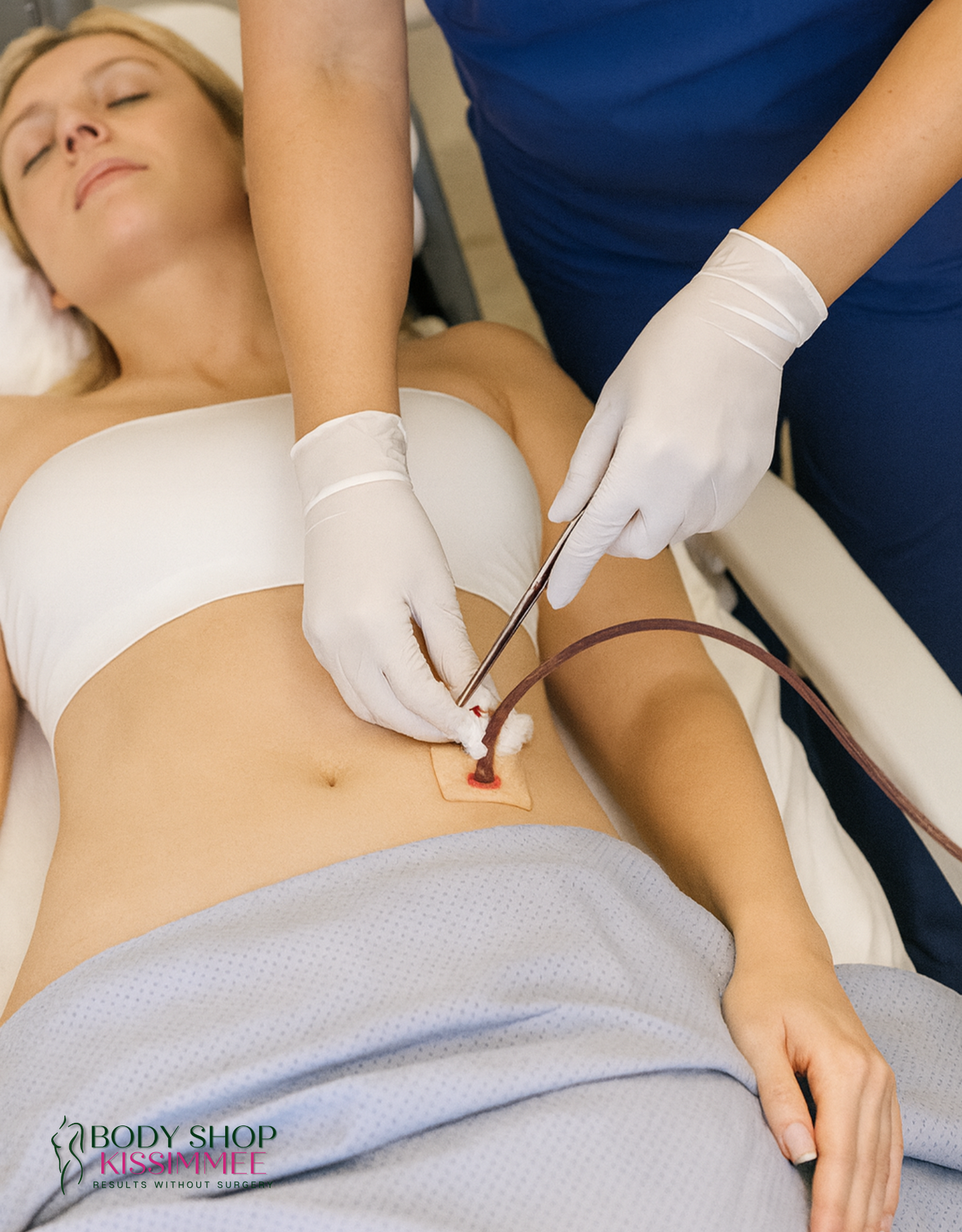 Post Op Drain Removal