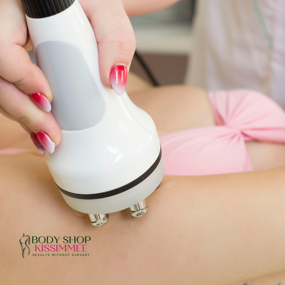 Multipolar Radio Frequency (RF)