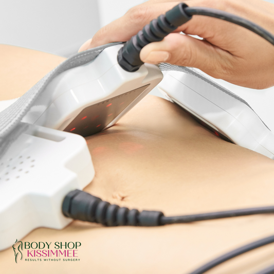 Laser Lipo